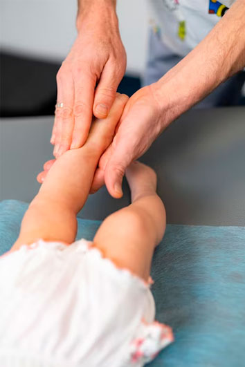 fisioterapia-en-el-lactante-displasia1