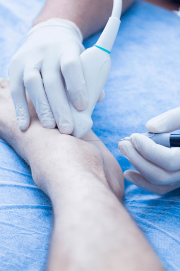 fisioterapia-invasiva-neuromodulación5